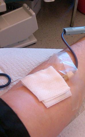 W Polsce zarejestrowanych jest już ponad milion niespokrewnionych potencjalnych dawców szpiku kostnego. Tylko 1 proc. z nich zostanie dawcami